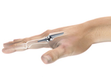 Artificial Finger Joint Replacement