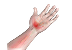 Carpal Tunnel Release Surgery