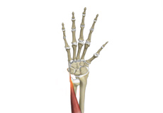 Extensor Carpi Ulnaris (ECU) Tendon Instability